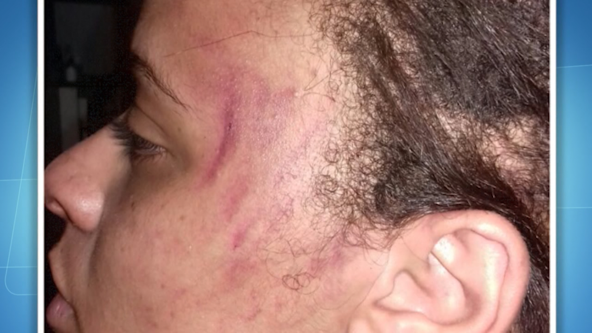Abuso: mulher diz que foi agredida por Policiais Militares